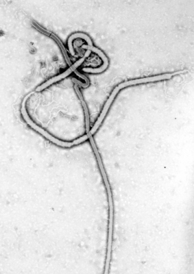wirus Ebola,  from Centers for Disease Control and Prevention's Public Health Image Library